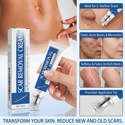 Advanced Scar Removal Cream